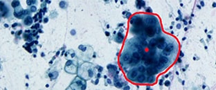 Microdissection laser et pinces optiques